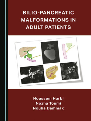 cover image of Bilio-Pancreatic Malformations in Adult Patients